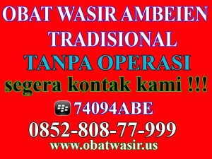 Illustration for article titled Cara Menyembuhkan Wasir Eksternal